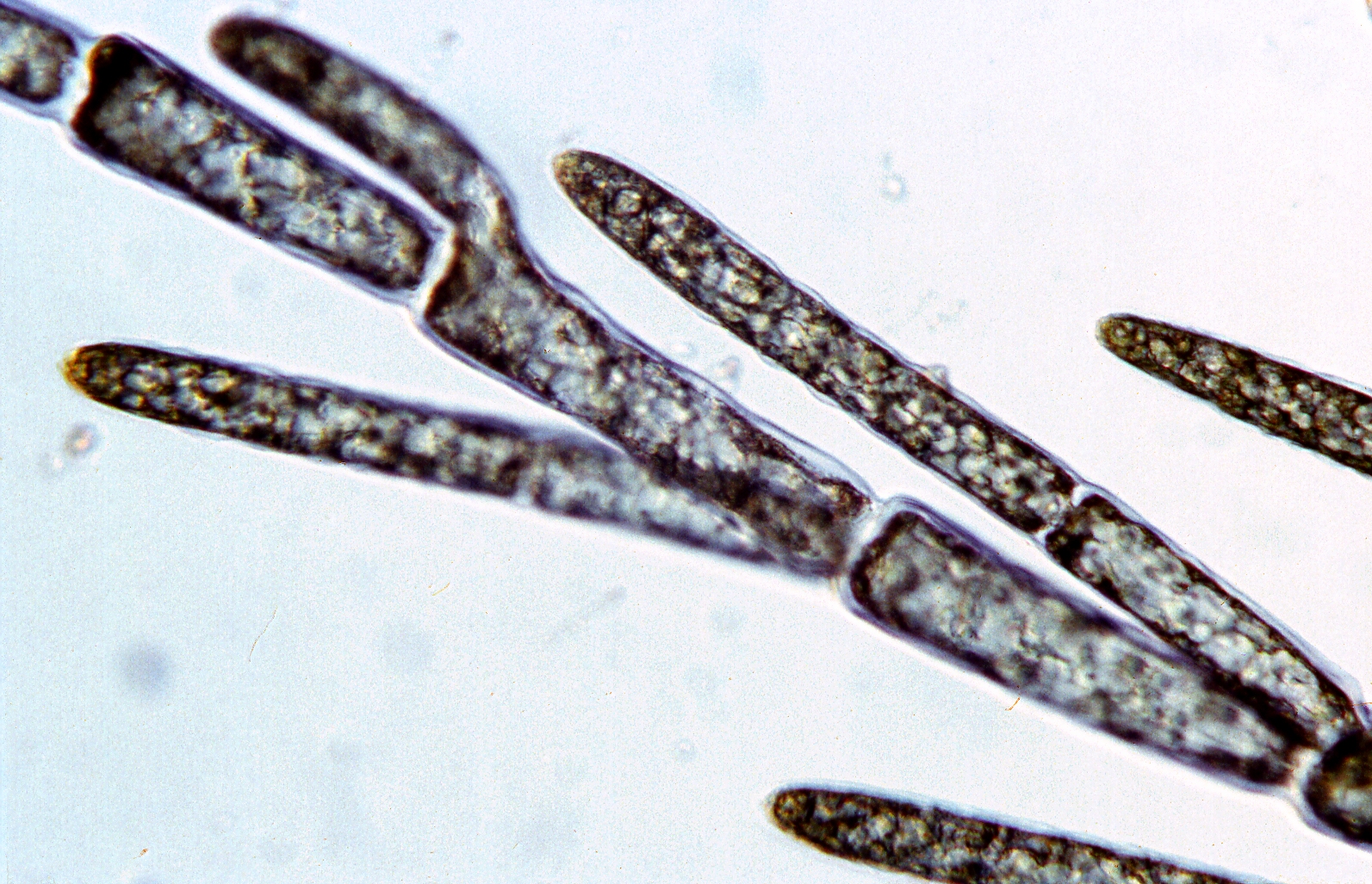 Нитчатая зеленая водоросль Cladophora крупным планом